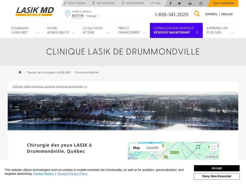Aperçu de LASIK MD